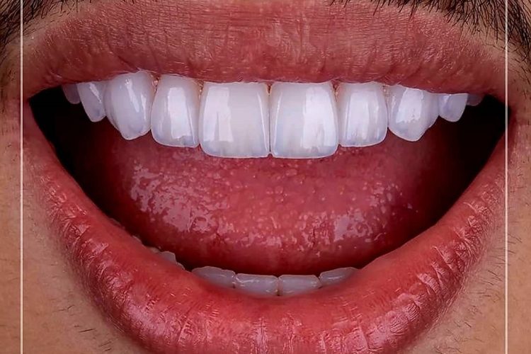 گالری لبخند و نمونه کار ها