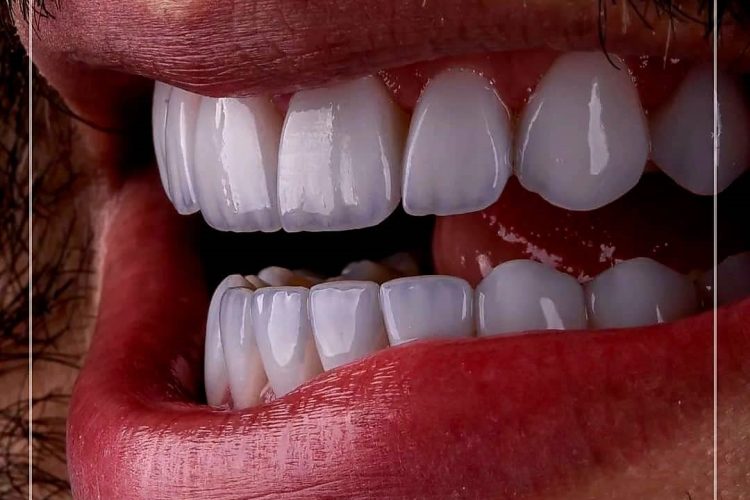 گالری لبخند و نمونه کار ها