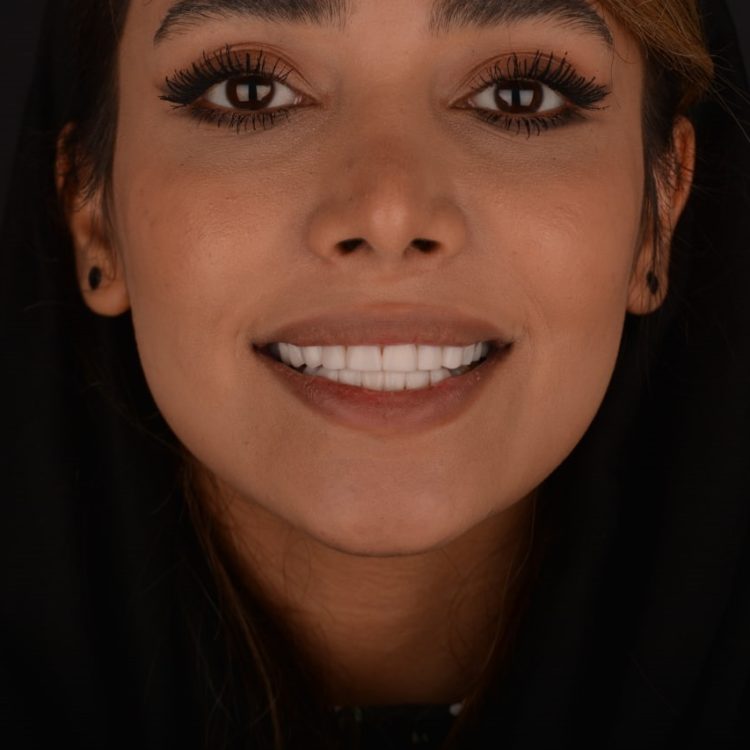 گالری لبخند و نمونه کار ها