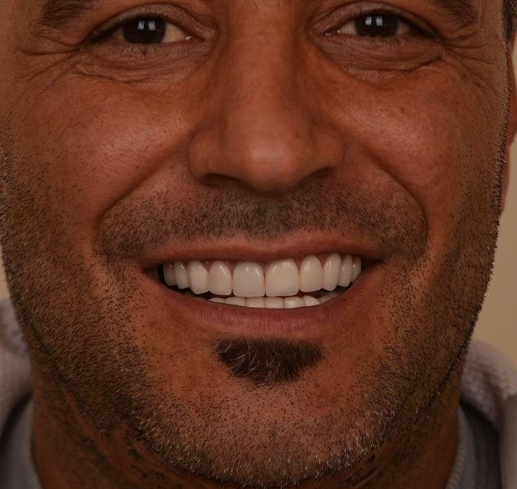 گالری لبخند و نمونه کار ها