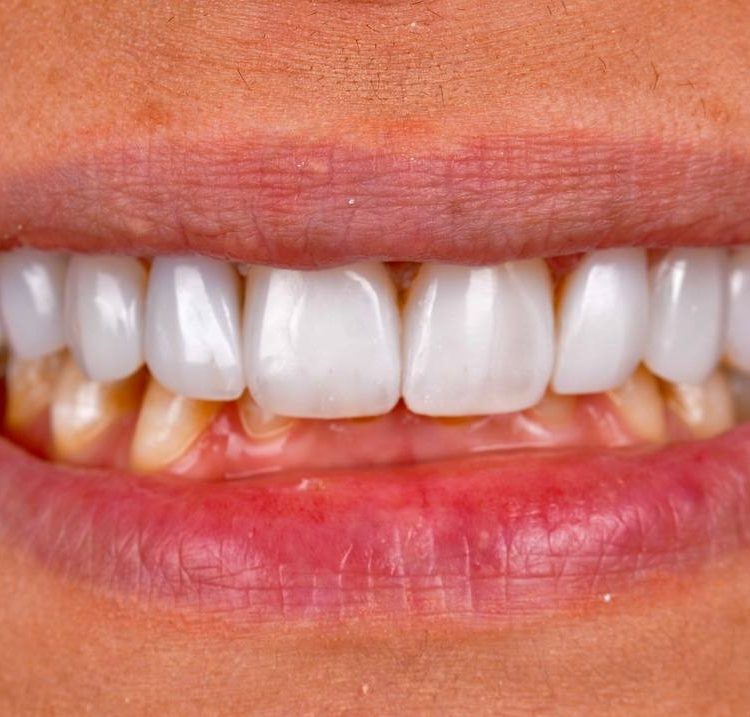 گالری لبخند و نمونه کار ها