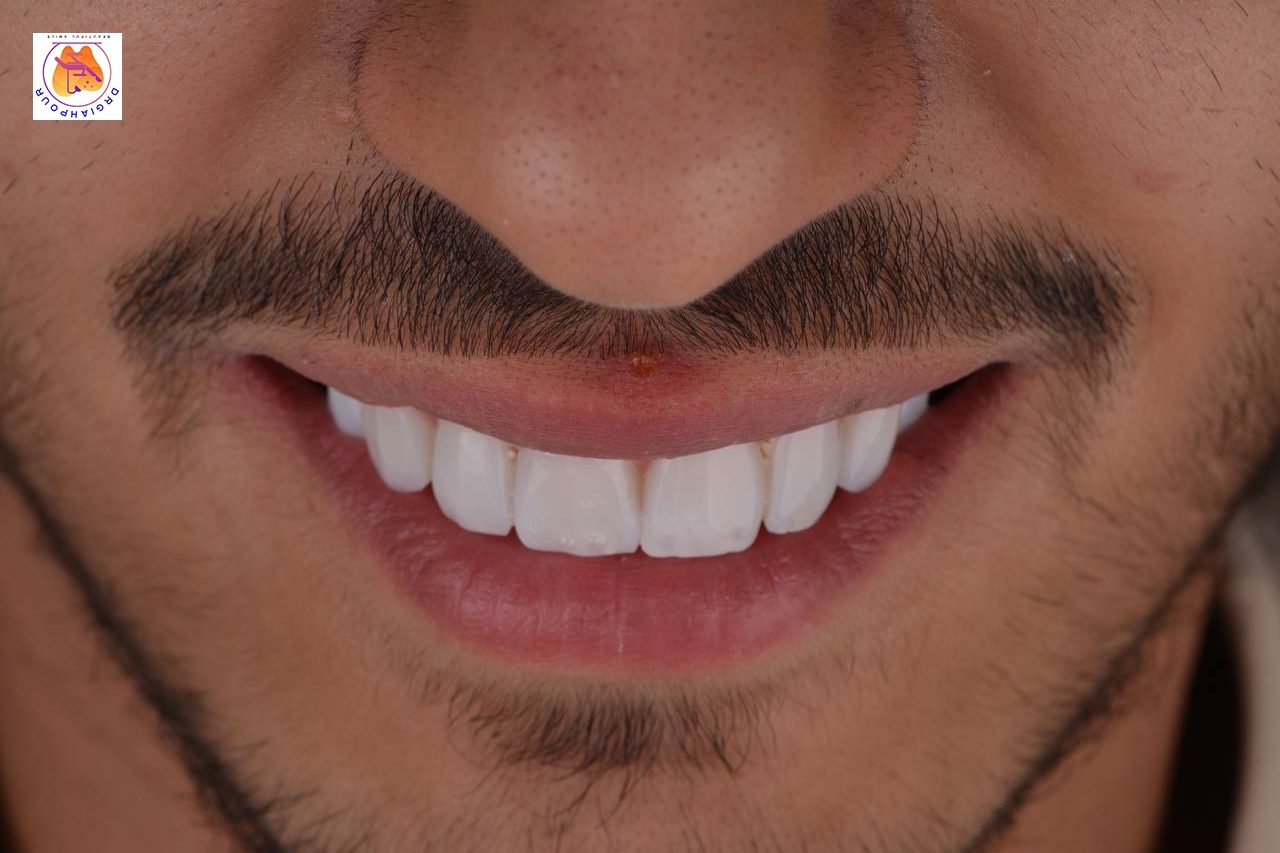 گالری نمونه کار ها