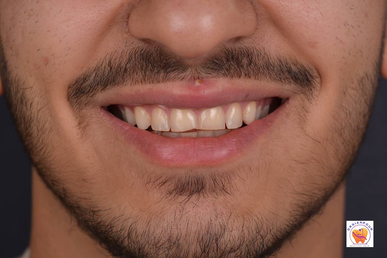گالری لبخند و نمونه کار ها