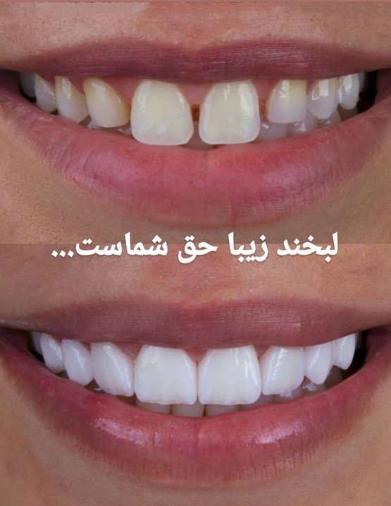 گالری لبخند و نمونه کار ها