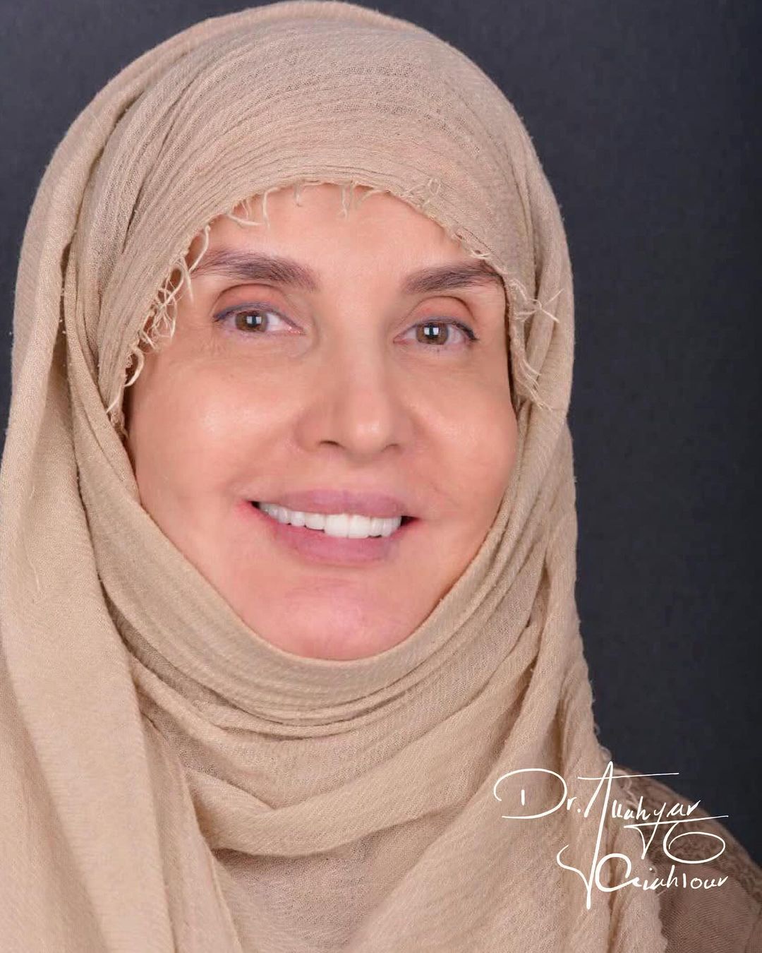 گالری لبخند و نمونه کار ها