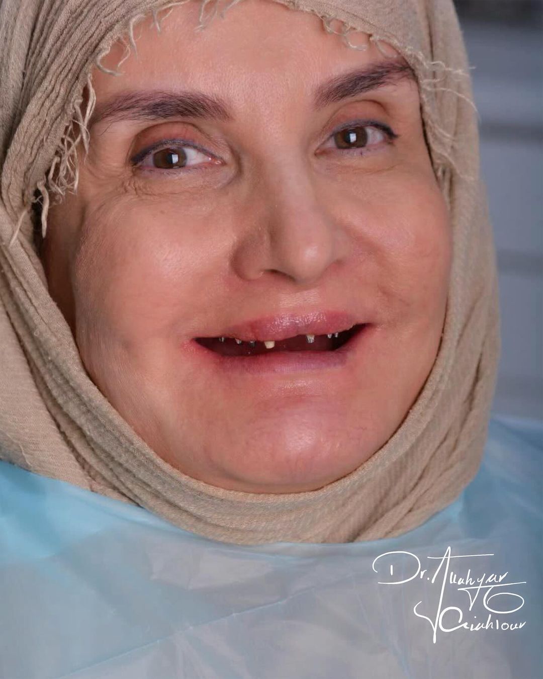 گالری لبخند و نمونه کار ها