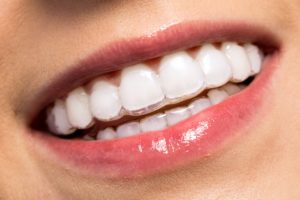 گالری لبخند و نمونه کار ها