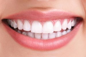 گالری لبخند و نمونه کار ها