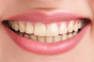 گالری لبخند و نمونه کار ها
