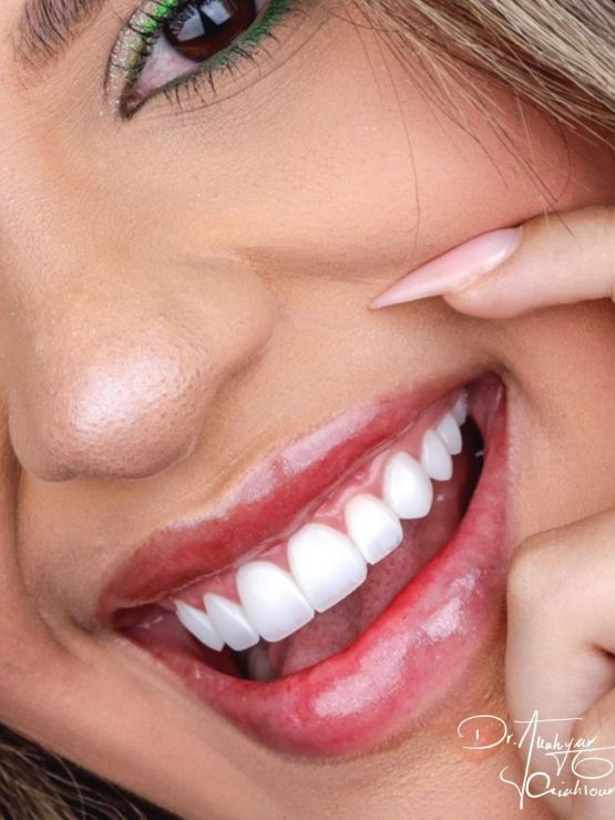 گالری لبخند و نمونه کار ها