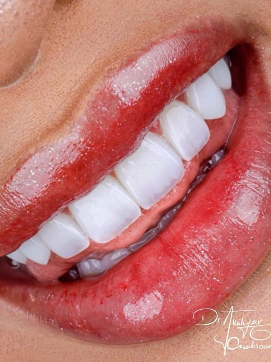 گالری لبخند و نمونه کار ها