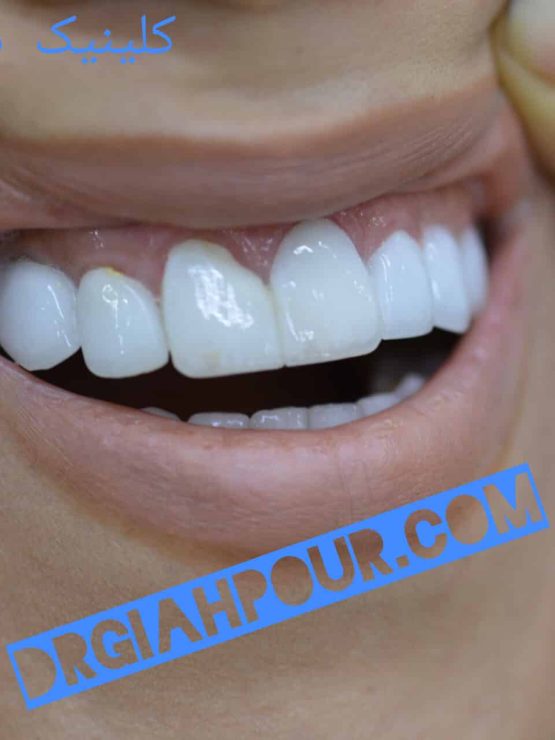 گالری لبخند و نمونه کار ها