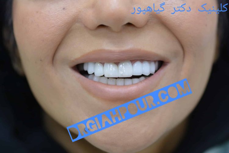 گالری لبخند و نمونه کار ها