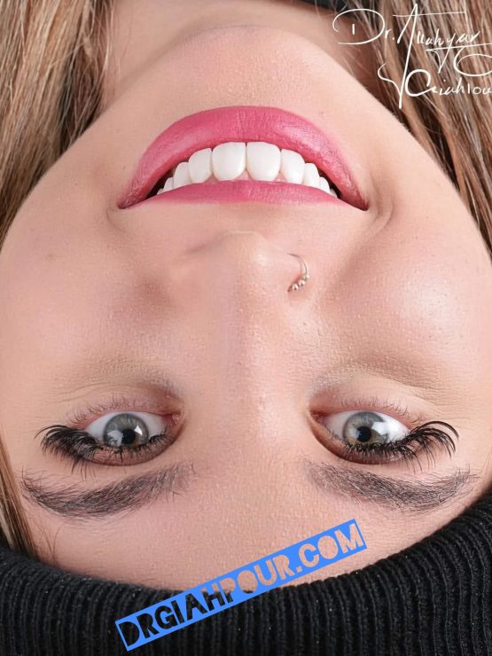 گالری لبخند و نمونه کار ها