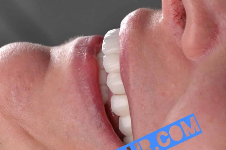 گالری لبخند و نمونه کار ها