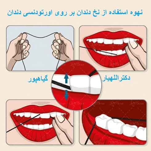 جرمگیری با ارتودنسی: تمام آنچه باید بدانید! (از زبان دکتر گیاهپور)