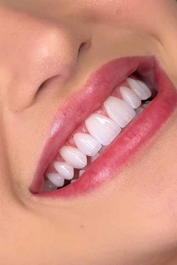 جرمگیری با ارتودنسی: تمام آنچه باید بدانید! (از زبان دکتر گیاهپور)